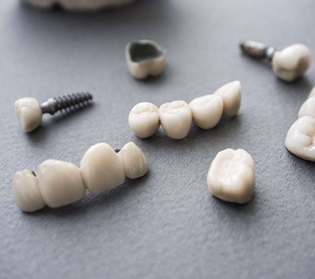 Milwaukee The Difference Between Dental Implants and Mini Dental Implants